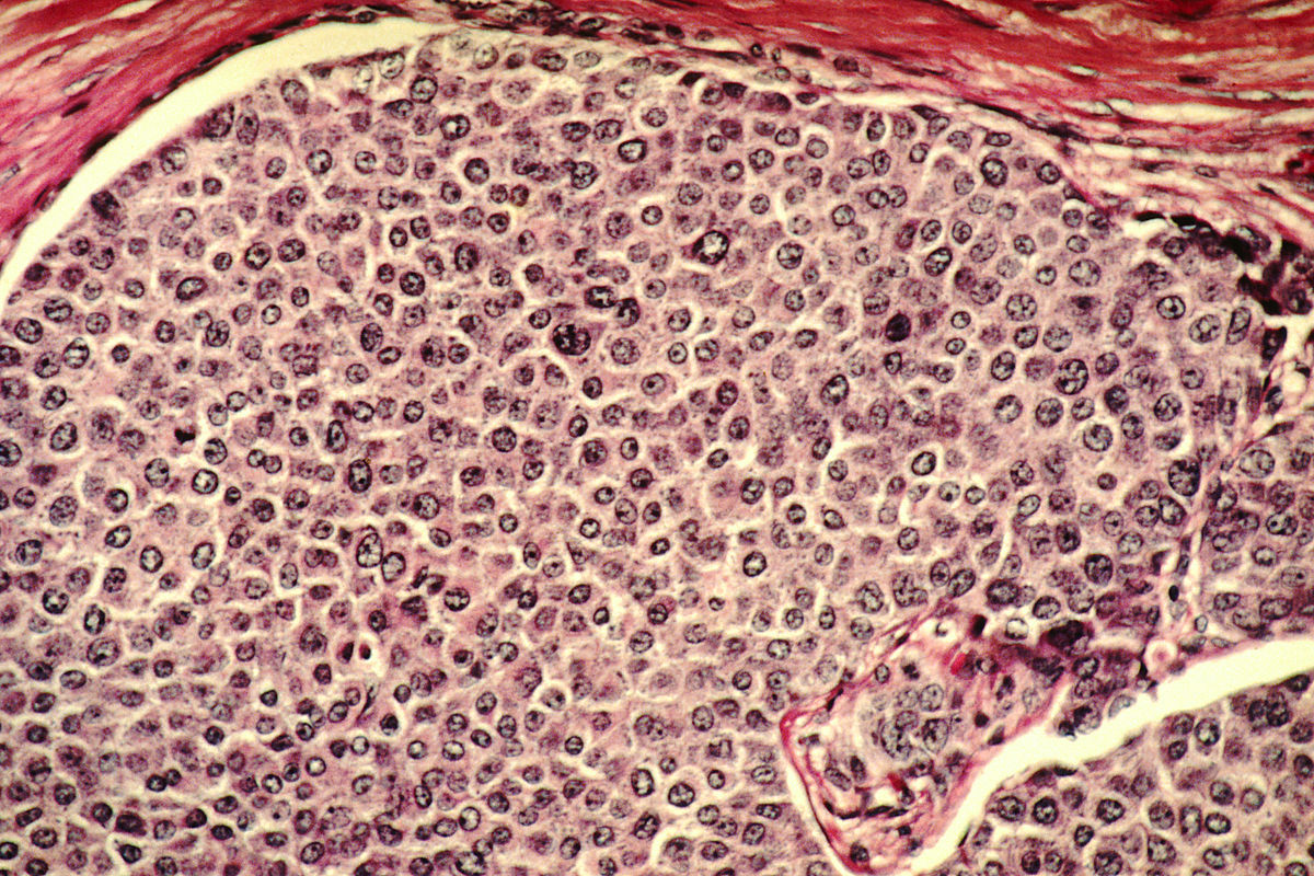 Cancer's Oxygen Paradox: Thriving in High and Low O2 Environments
